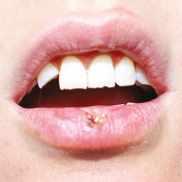 EUT - Party time (LP)