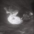 Alice Phoebe Lou - Glow (LP) - Velvet Music